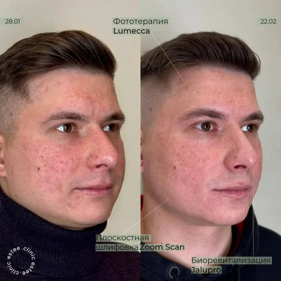 Комплексный подход